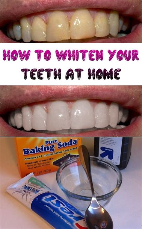 Ways To Clean Your Teeth At Home Teeth Poster