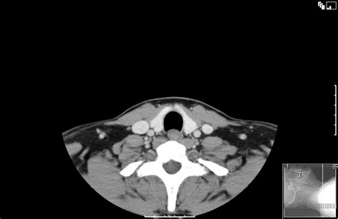 Axial Neck Ct Diagram 2 Diagram Quizlet