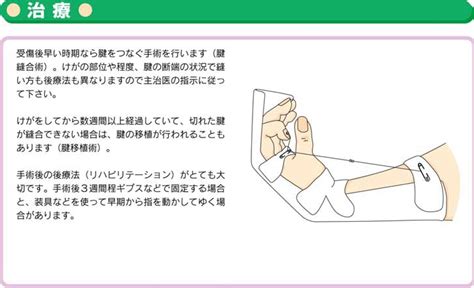 手指の屈筋腱損傷｜お知らせ｜溝口病院救急指定病院福岡