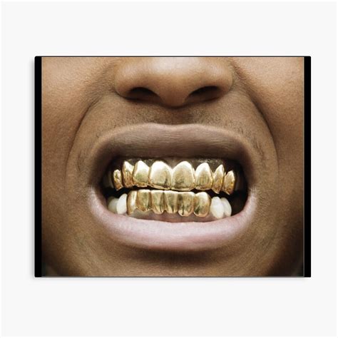 Grillz Asap Rocky Gold Teeth
