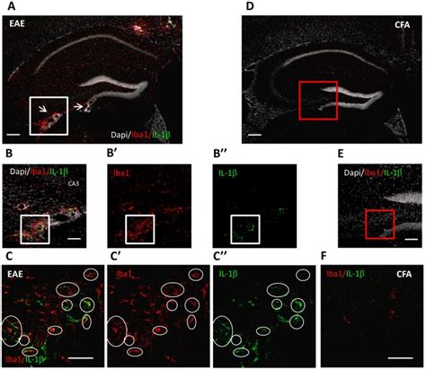 Double Immunostaining Of Hippocampal Coronal Sections Showing