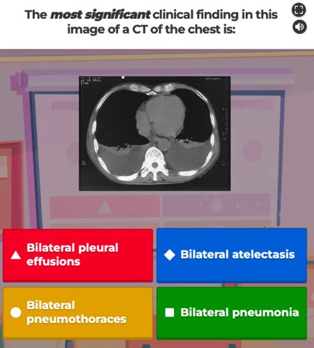 Ct Kahoot Flashcards Quizlet