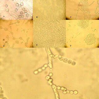 Solated Yeast A Candida Albicans B C Tropicalis C C Kefyr D C