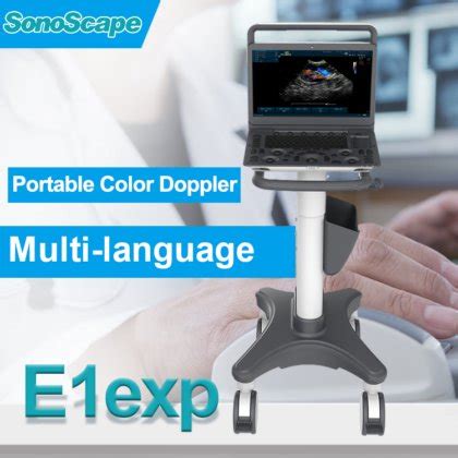 Sonoscape E Expert Color Doppler Sonoscape Medical Ultrasound