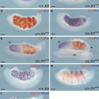 Partial XY Sex Reversal In Cited2 Sf1 Double Mutant Gonads E13 5 XY