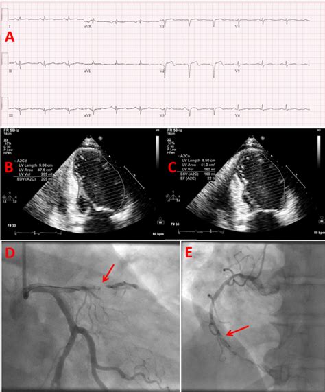 Etx Diabetes Ch36 Fig1 Endotext
