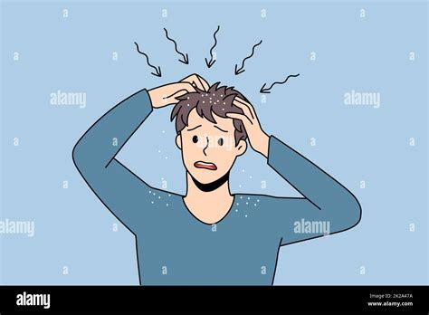 itchy head  dandruff concept stock photo alamy