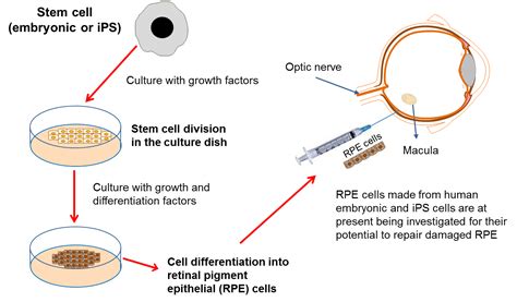 The Eye And Stem Cells The Path To Treating Blindness Locumotive