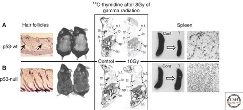 Pathologies Associated with the p53 Response