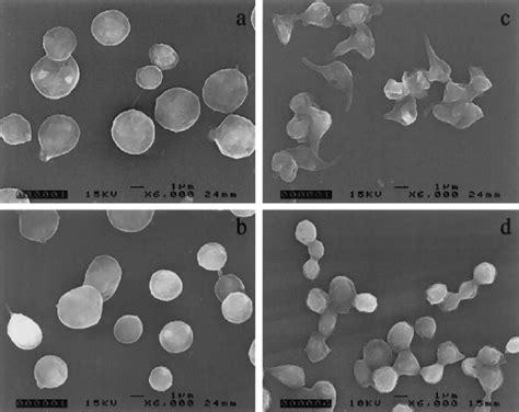 Scanning Electron Micrographs Of Platelets From The Homozygous Patient