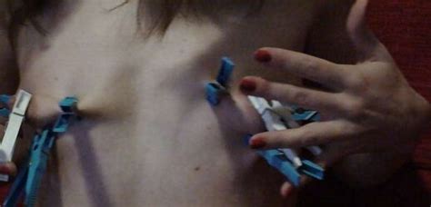 Forceps On My Melons Fervor Gal German Fledgling ZB Porn