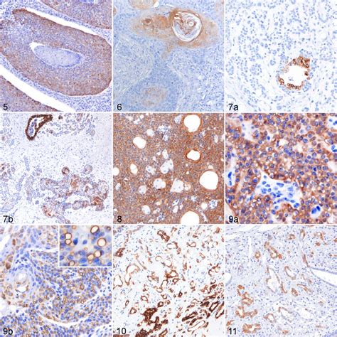 Cutaneous Epithelial Tumors Dog Figure 5 Basal Cell Carcinoma Tumor