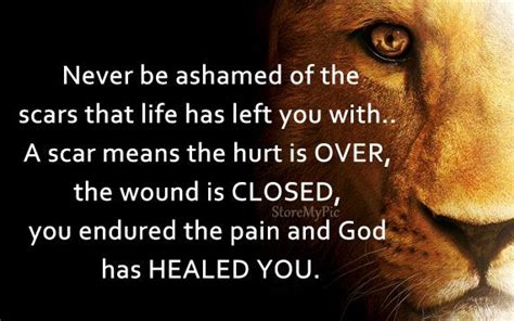 Embrace Your Scars