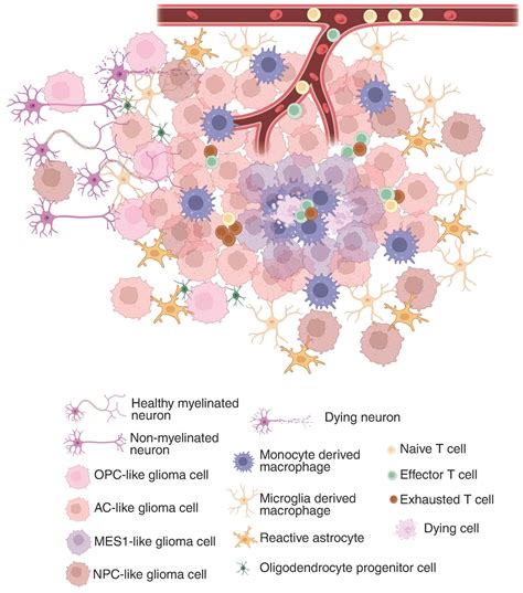 unraveling glioblastoma heterogeneity advancing immunological insights