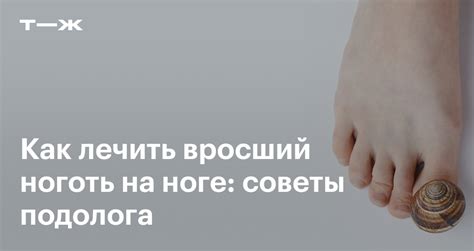 Вросший ноготь: что делать, причины, лечение без операции, осложнения ...