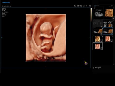 Ultrasound Images • Fetus Early Gestation Realistic Vue 3d