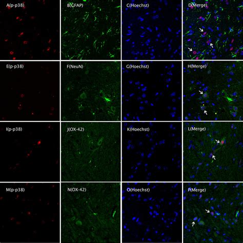 Colocalization Of P P With Ox And Neun Double Immunofluorescence