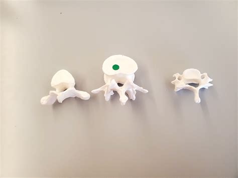 Vertebrae Diagram | Quizlet