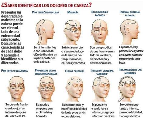 Que Parte De La Cabeza Duele Por Estres Mentalidad Humana