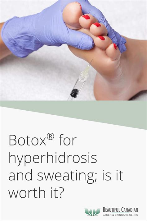 Botox For Hyperhidrosis Sweating Is It Worth It Vancouver Botox