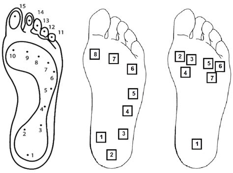 Supination Footprint