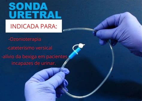 Sonda Uretral De Al Vio Cpl Unid N Mercadolivre