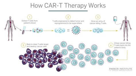 leukemia  cancer   car  immunotherapy saved emily