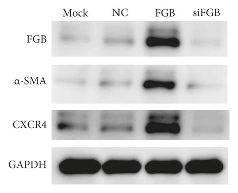 Knockdown Of Fgb Inhibits Hbmec Proliferation And Angiogenesis A The