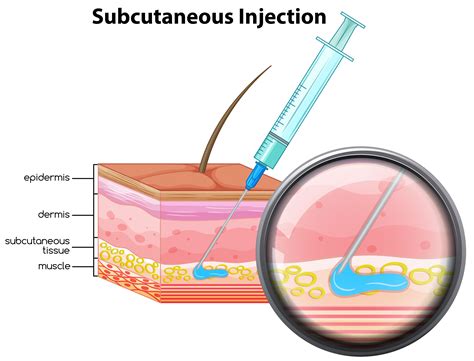 Subcutaneous Injection Site Chart