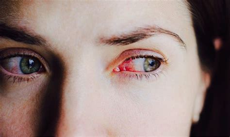 Капли для глаз от покраснения и усталости: список эффективных препаратов