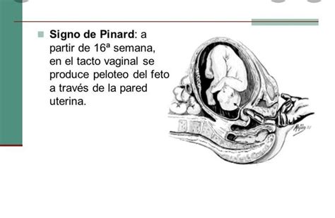 Pin De Pilar En Obstetricia Y Puericultura Obstetricia Y Puericultura