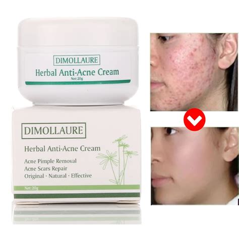 Dimollaure, травяной женьшень, крем от прыщей, прыщей, пятен, шрамы от ...