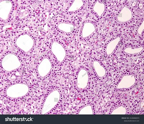 2 Renal Papilla Histology Royalty-Free Images, Stock Photos & Pictures ...