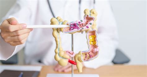 Mortes por câncer colorretal crescem 20 5 em 30 anos na América Latina Estadão