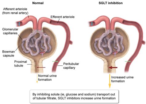 Osmotic vs. Hydrostatic Pressures & the Kidney : r/Mcat