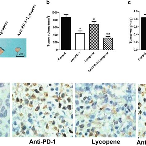 Lycopene Improves The Efficiency Of Anti Pd 1 Therapy 1 × 10⁶ Llc