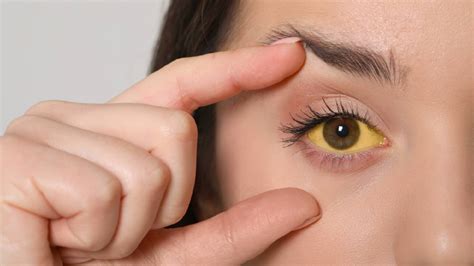 9 Things Your Eyes Tell You About Your Health Healthshots