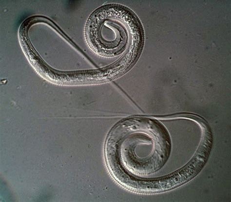 Dracunculiasis | Parasite Diagnosis