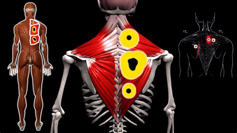 БОЛЬ В СПИНЕ и ТРИГГЕРНЫЕ ТОЧКИ - YouTube