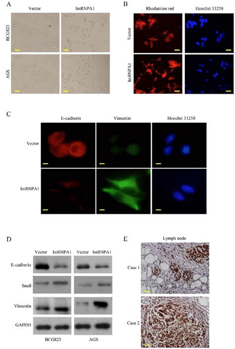 HnRNPA1 Regulates EMT In Vitro A Morphology Of Stable Vector And