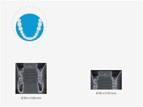 DVT Überweiser - Informationen rund um die Digitale Volumentomographie