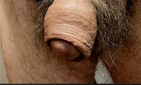 Glans Revealed And Cock Fills Up Full Free Gay Hd Porn Xhamster