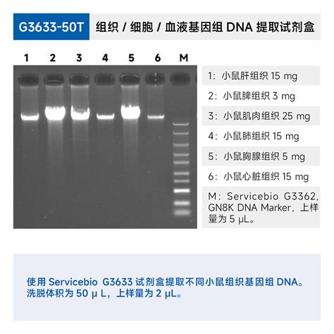 Nucleic Acid Extraction Kits VYANABIOTECH