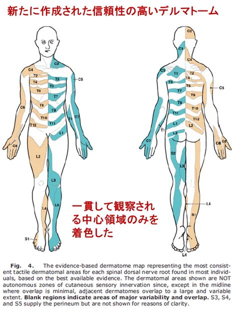 教科書のデルマトームは正しくはない ―驚くべき皮膚感覚マップの作成の歴史― - Neurology 興味を持った「脳神経内科」論文