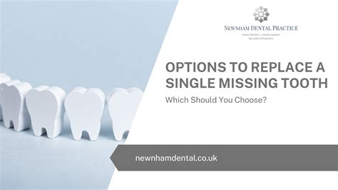 options  replace  single missing tooth    choose