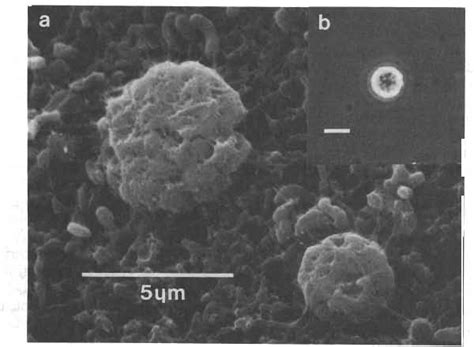 Scanning Electron Micrograph A Of Two Complex Cell Aggregates On A