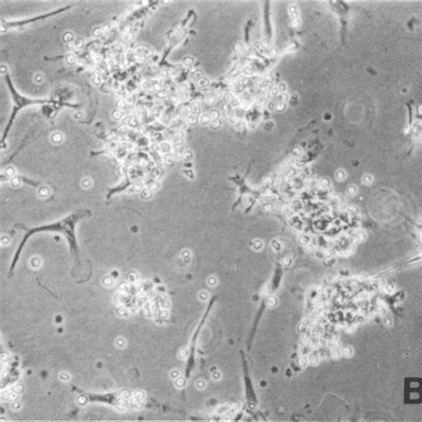 Phase Contrast Microscopy Of Tumoral Cells In Culture X 140 A Download Scientific Diagram