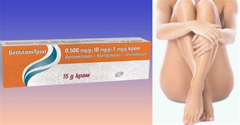 Мнения за крем Бетазон Трио. За какво се използва Бетаметазон - Косопад