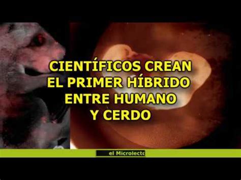 Cient Ficos Crean El Primer H Brido Entre Humano Y Cerdo Youtube