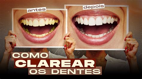 Como CLAREAR OS DENTES No Photoshop YouTube